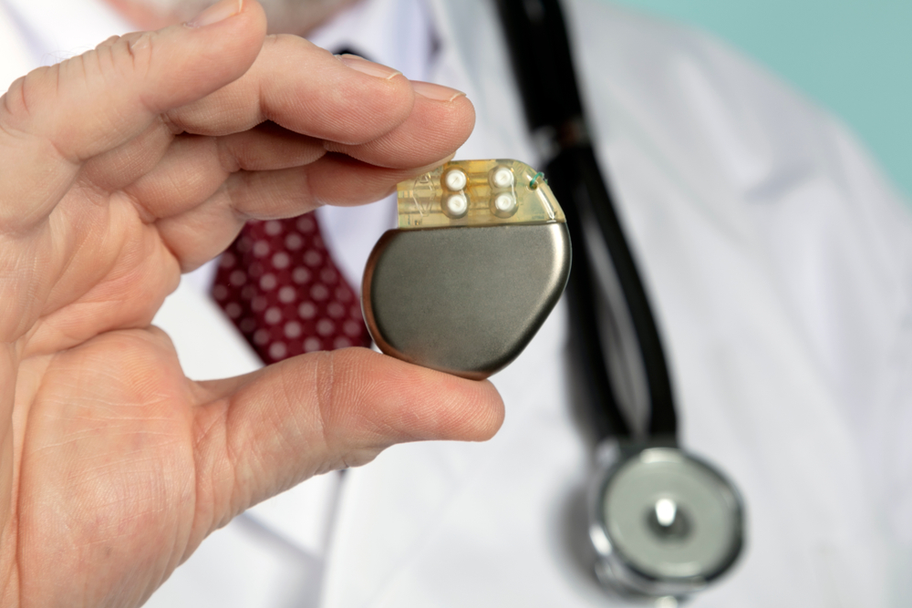 Doctor holding pacemaker
