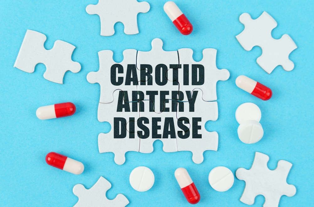 On a blue background, pills, capsules and puzzles with the inscription - Carotid artery disease.