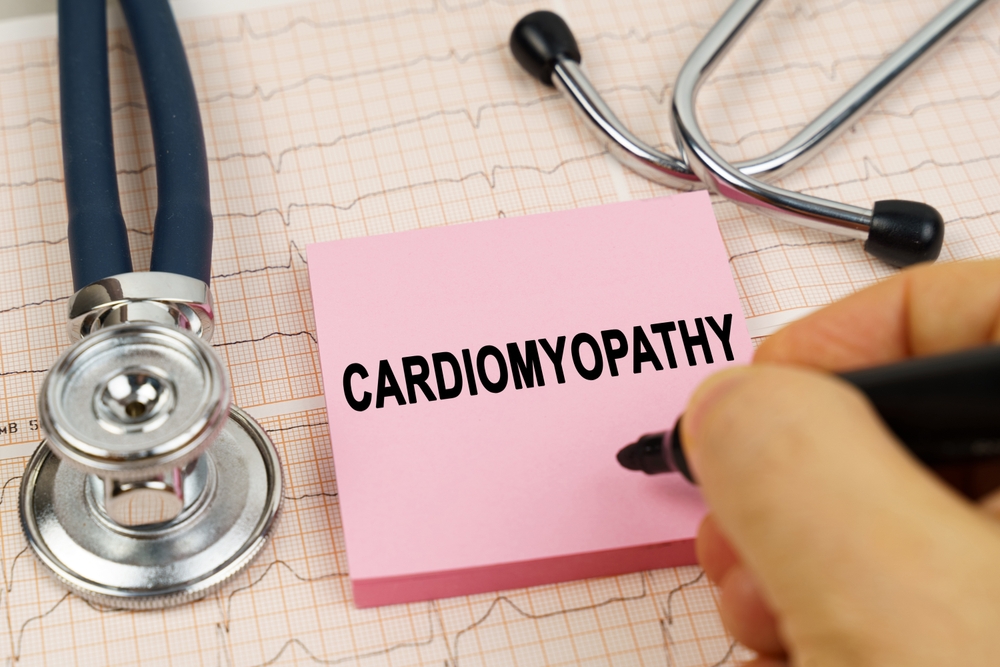 cardiomyopathy written on sticky note.