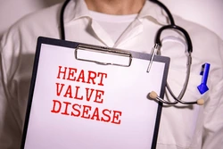 Heart valve disease